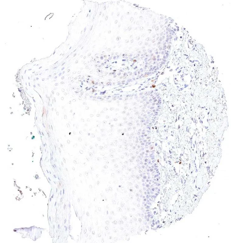 TIGIT positive lymphocytes in the subepithelial tissue of the lip (oral epithelium).
