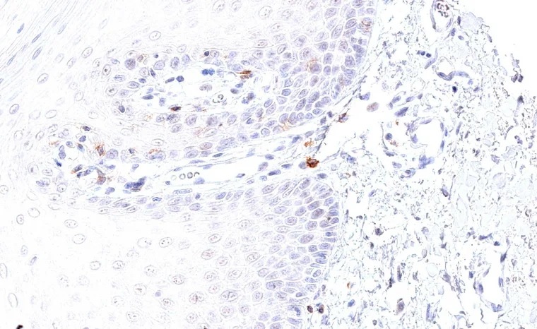 TIGIT positive lymphocytes in the subepithelial tissue of the lip (oral epithelium).