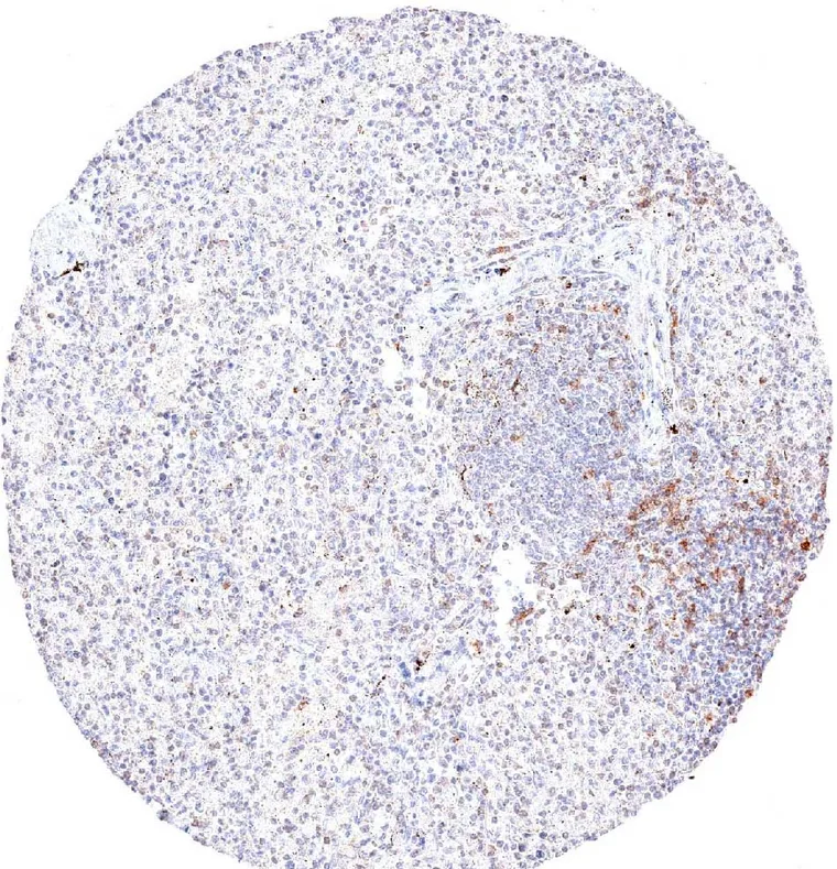 Abundant TIGIT positive lymphocytes in the spleen.
