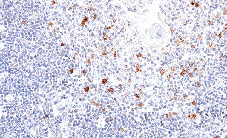 TIGIT positive lymphocytes are frequent in the thymus.