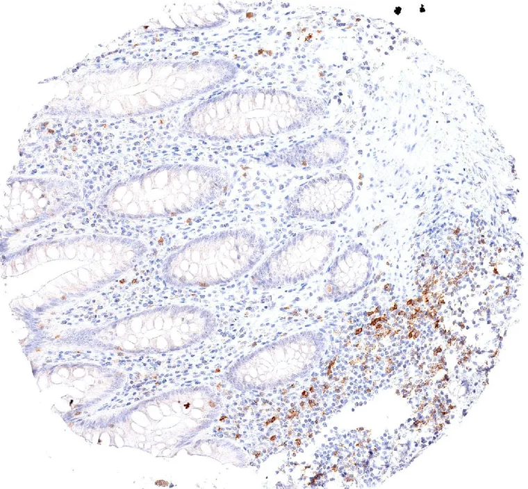 Appendix mucosa with TIGIT positive lymphocytes.