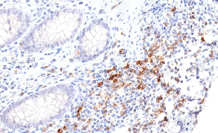 Appendix mucosa with TIGIT positive lymphocytes.