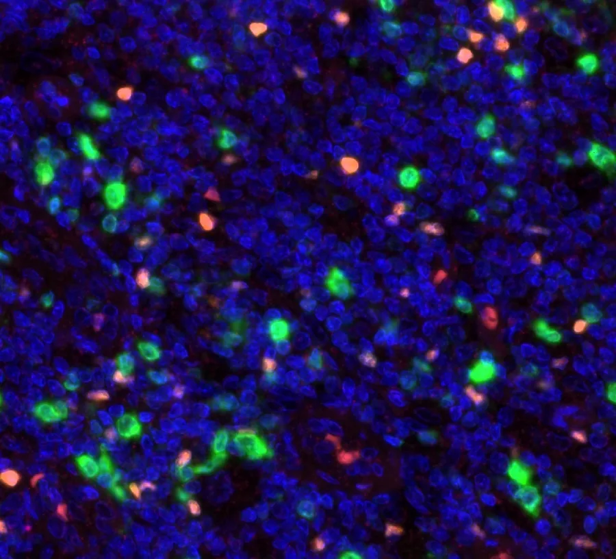 Multicolor immunofluorescence of FOXP3 (red; anti-FOXP3 clone FX3, DIA-FX3) and CD112R/PVRIG (green; anti-CD112R clone R12, DIA-R12), magnification 40×, normal human tonsil – figure 02 of the ONCOdianova FOXP3 gallery and figure C of the datasheet.