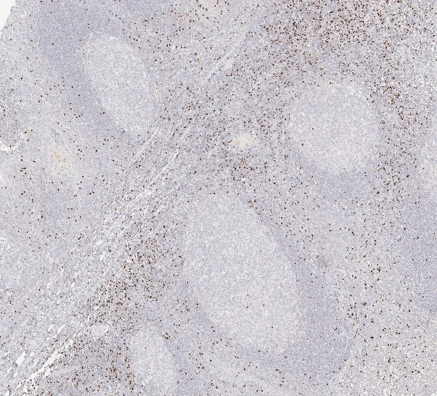 Immunohistochemistry of human FOXP3 with anti-FOXP3 clone FX3 (DIA-FX3) in FFPE tissue – FOXP3-positive cells in tonsil, overview, 5×; figure 08 of the ONCOdianova FOXP3 gallery.