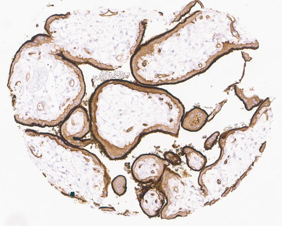 Immunohistochemistry of human CD73 (NT5E) with anti-CD73 clone KK3 (DIA-KK3) in FFPE tissue – strong CD73 positivity of the superficial membrane of the syncytiotrophoblast in placenta; figure 09 of the ONCOdianova CD73 gallery.
