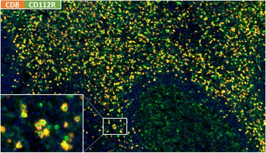 Fluorescence multiplex immunohistochemistry of a normal human tonsil with anti-CD8 clone TC8 (DIA-TC8; orange/red) and anti-CD112R/PVRIG clone R12 (DIA-R12; green), nuclei blue – overlay with detail inset; figure B of datasheet DIA-R12 and figure 01 of the ONCOdianova CD112R gallery.