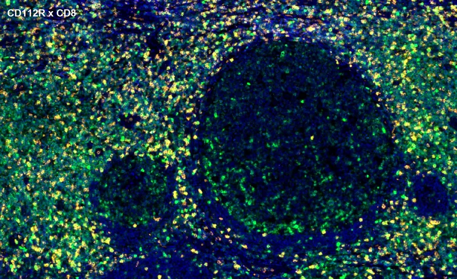 Fluorescence multiplex immunohistochemistry of CD112R/PVRIG (clone R12, DIA-R12; green) and CD8 (orange) in human FFPE tissue – overlay CD112R × CD8 around lymphoid follicles, overview; figure 13 of the ONCOdianova CD112R gallery.
