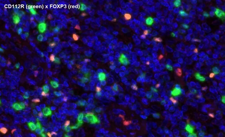 Multicolor immunofluorescence of CD112R/PVRIG (green; clone R12) and FOXP3 (red), magnification 40×, normal human tonsil – figure 15 of the ONCOdianova CD112R gallery.