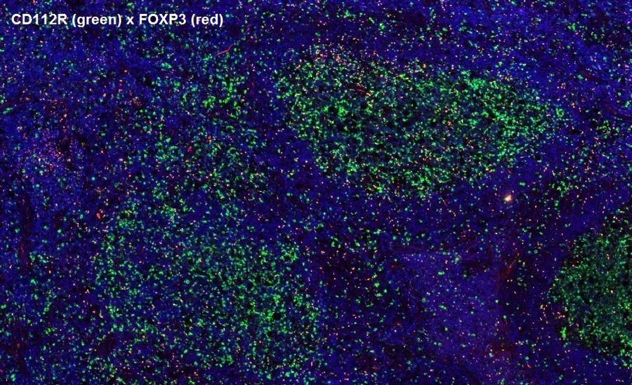 Multicolor immunofluorescence of CD112R/PVRIG (green; clone R12) and FOXP3 (red), magnification 4×, normal human tonsil – figure 14 of the ONCOdianova CD112R gallery.